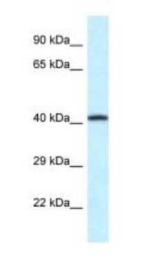 Western Blot: P2X2/P2RX2 Antibody [NBP1-82393]