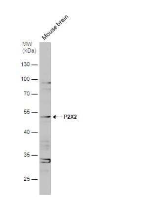 Western Blot: P2X2/P2RX2 Antibody [NBP2-19656]