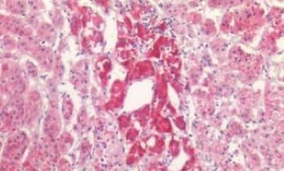 Immunohistochemistry-Paraffin: P2X3/P2RX3 Antibody [NBP3-14436]