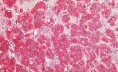 Immunohistochemistry-Paraffin: P2X3/P2RX3 Antibody [NBP3-14437]