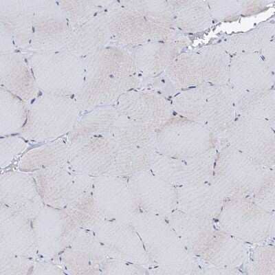 Immunohistochemistry-Paraffin: P2X4 Antibody [NBP1-92239]