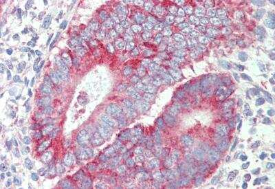 Immunohistochemistry-Paraffin: P2X4 Antibody [NBP2-27567]