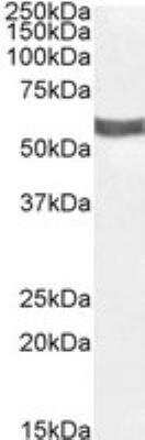 Western Blot: P2X4 Antibody [NBP1-00141]