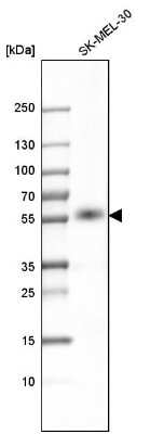 Western Blot: P2X4 Antibody [NBP1-92239]