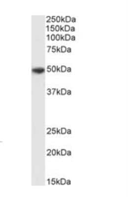 Western Blot: P2X4 Antibody [NBP2-27567]