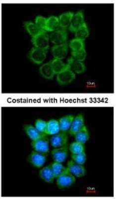 Immunocytochemistry/ Immunofluorescence: P2X5/P2RX5 Antibody [NBP2-19658]