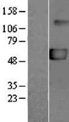 Western Blot: P2X5/P2RX5 Overexpression Lysate [NBL1-14031]