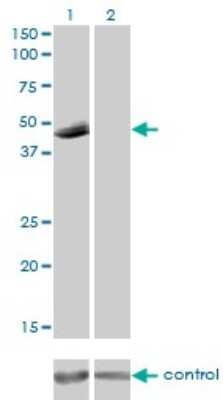 Western Blot: P2X5/P2RX5 Antibody (1C5) [H00005026-M01]