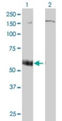 Western Blot: P2X5/P2RX5 Antibody (1C5) [H00005026-M01]