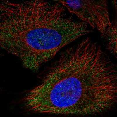 Immunocytochemistry/ Immunofluorescence: P2X5/P2RX5 Antibody [NBP2-56419]