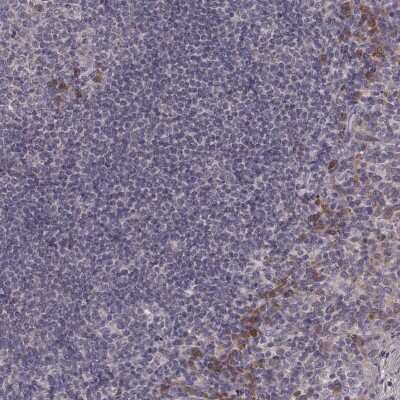 Immunohistochemistry-Paraffin: P2X5/P2RX5 Antibody [NBP2-56419]