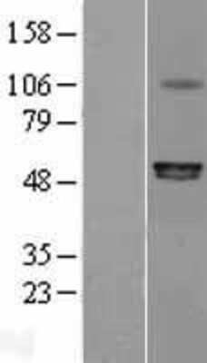 Western Blot: P2X6/P2RX6 Overexpression Lysate [NBL1-14032]