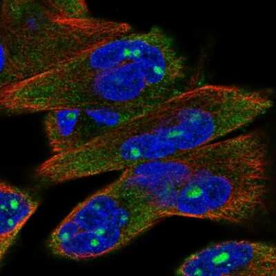 Immunocytochemistry/ Immunofluorescence: P2X6/P2RX6 Antibody [NBP2-48583]