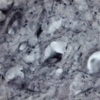 Immunohistochemistry Free-Floating: P2X6/P2RX6 Antibody - Azide and BSA Free [NBP1-30565]