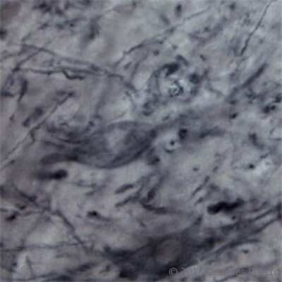 Immunohistochemistry Free-Floating: P2X6/P2RX6 Antibody - Azide and BSA Free [NBP1-30565]