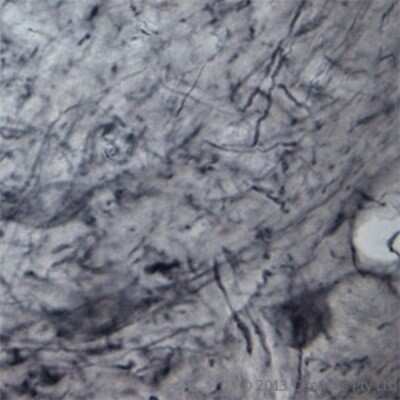 Immunohistochemistry: P2X6/P2RX6 Antibody - Azide and BSA Free [NBP1-30565]