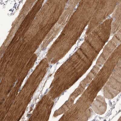 Immunohistochemistry: P2X6/P2RX6 Antibody [NBP2-48584]