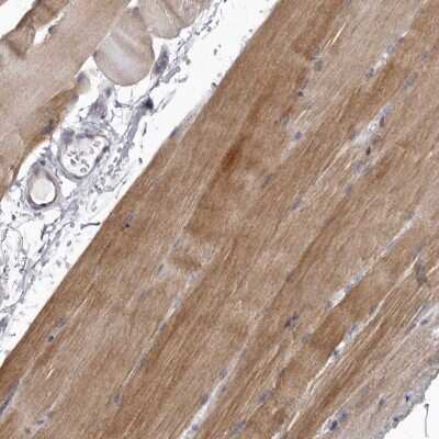 Immunohistochemistry-Paraffin: P2X6/P2RX6 Antibody [NBP2-48583]