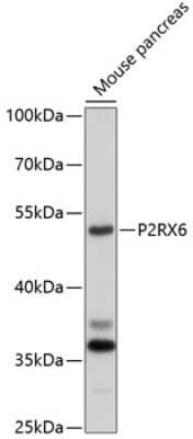 Western Blot: P2X6/P2RX6 AntibodyBSA Free [NBP2-93169]