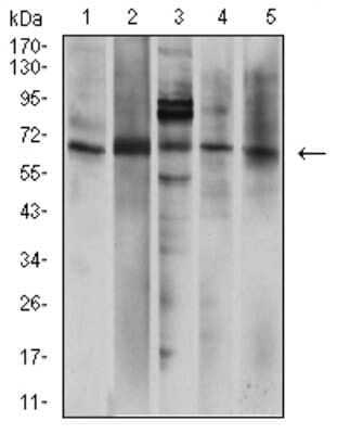 Western Blot: P2X7/P2RX7 Antibody (7G1D6)BSA Free [NBP2-61748]