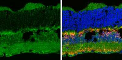 Immunohistochemistry-Frozen: P2X7/P2RX7 Antibody [NBP1-32470]