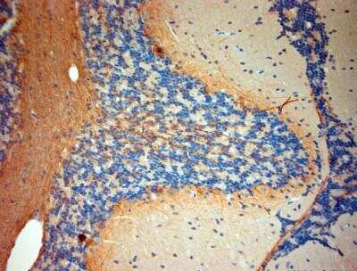 Immunohistochemistry-Paraffin: P2X7/P2RX7 Antibody [NBP1-20180]