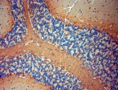 Immunohistochemistry-Paraffin: P2X7/P2RX7 Antibody [NBP1-20180]