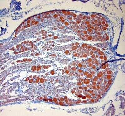 Immunohistochemistry-Paraffin: P2X7/P2RX7 Antibody [NBP1-20180]