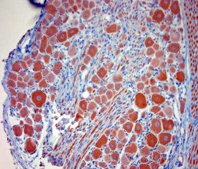 Immunohistochemistry-Paraffin: P2X7/P2RX7 Antibody [NBP1-20180]
