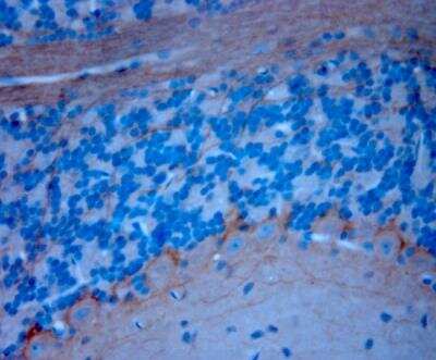 Immunohistochemistry-Paraffin: P2X7/P2RX7 Antibody [NBP1-20180]