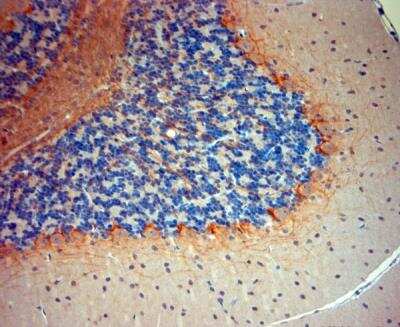 Immunohistochemistry-Paraffin: P2X7/P2RX7 Antibody [NBP1-20180]