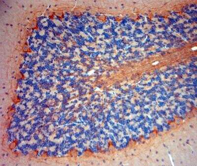 Immunohistochemistry-Paraffin: P2X7/P2RX7 Antibody [NBP1-20180]