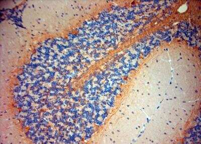 Immunohistochemistry-Paraffin: P2X7/P2RX7 Antibody [NBP1-20180]