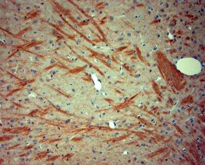 Immunohistochemistry-Paraffin: P2X7/P2RX7 Antibody [NBP1-20180]