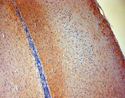 Immunohistochemistry-Paraffin: P2X7/P2RX7 Antibody [NBP1-20180]