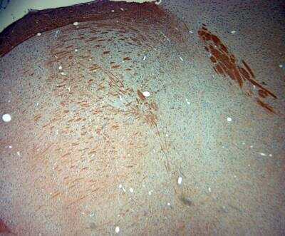 Immunohistochemistry-Paraffin: P2X7/P2RX7 Antibody [NBP1-20180]