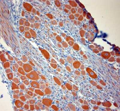 Immunohistochemistry-Paraffin: P2X7/P2RX7 Antibody [NBP1-20180]