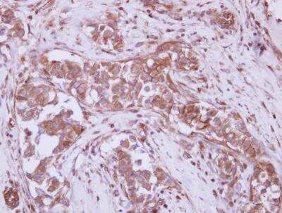 Immunohistochemistry-Paraffin: P2X7/P2RX7 Antibody [NBP1-32470]