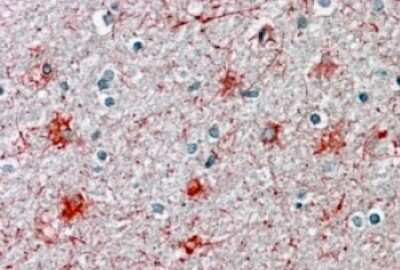 Immunohistochemistry-Paraffin: P2X7/P2RX7 Antibody [NBP1-37775]