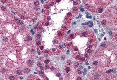 Immunohistochemistry-Paraffin: P2X7/P2RX7 Antibody [NBP1-37775]