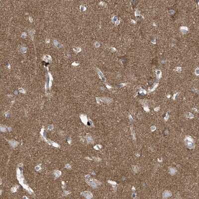 Immunohistochemistry-Paraffin: P2X7/P2RX7 Antibody [NBP1-82738]