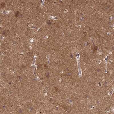 Immunohistochemistry-Paraffin: P2X7/P2RX7 Antibody [NBP2-13720]