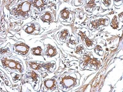 Immunohistochemistry-Paraffin: P2X7/P2RX7 Antibody [NBP2-19654]