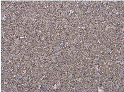 Immunohistochemistry-Paraffin: P2X7/P2RX7 Antibody [NBP2-19654]