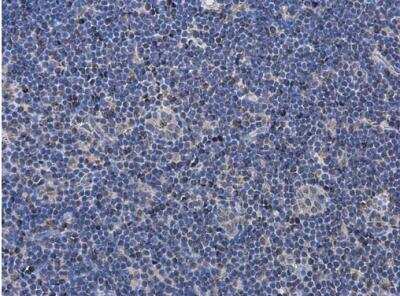 Immunohistochemistry-Paraffin: P2X7/P2RX7 Antibody [NBP2-19654]