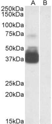 Western Blot: P2X7/P2RX7 Antibody [NBP1-37775]