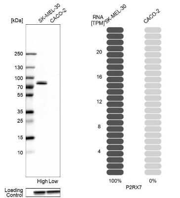 Western Blot: P2X7/P2RX7 Antibody [NBP1-82738]