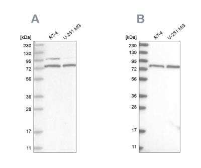 Western Blot: P2X7/P2RX7 Antibody [NBP1-82738]
