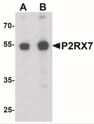 Western Blot: P2X7/P2RX7 AntibodyBSA Free [NBP2-41300]