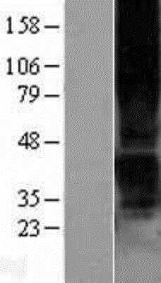 Western Blot: P2Y1/P2RY1 Overexpression Lysate [NBP2-04228]